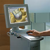 Cerec4.jpg